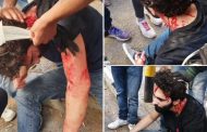 إصابة متظاهرين اثنين في وقفة احتجاجية أمام مصرف لبنان في الحمرا
