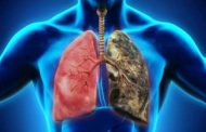 دراسة تكشف لغز إصابة غير المدخنين بمرض رئوي مزمن