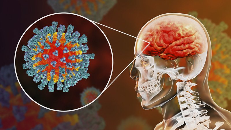 هل يهاجم كورونا الدماغ ويحرم خلاياه من الأوكسجين