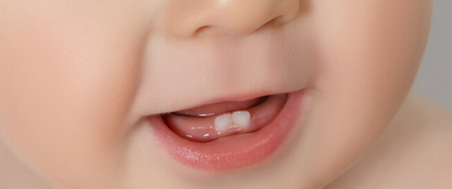 هكذا تعتنين بأسنان طفلك